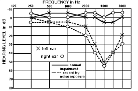 Hearing Tests Ajax On Oshawa On Pickering On