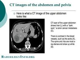 Talk to your doctor if this worries you. 14 Computed Tomography Ideas Medical Ct Scan Radiologist