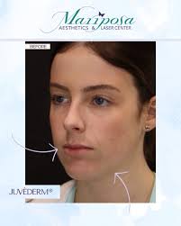 Mariposa Aesthetics & Laser Center