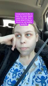 Jasmine Nurse Amputee