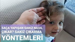 Sakız döşemeden nasıl çıkar? ya da çıkarabilsem bile ne kadarını çıkarabilirim? diye uzun uzun düşünmenize hiç gerek yok. Cimcime Ela Sakiz Cignerken Sakizi Sacina Yapistirdi Saca Yapisan Sakiz Nasil Cikar Yontemleri Youtube