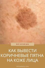 как избавиться от пигментных пятен на лице в домашних условиях Pismo Shikarnoe Plate Krasota Dan Lebih Banyak Lagi Pin Populer Di Pinterest Pinterest Yandeks Pochta Sredstva Dlya Kozhi Tovary Dlya Zdorovya Zdorove