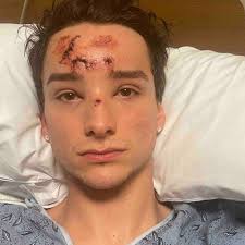 Aaron Partin's Instagram, Twitter & Facebook