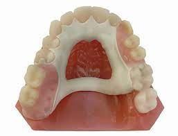 The most helpful thing that denture wearers can do is keep their dentures in good working order and clean. Improve Removable Partial Dentures With Innovation British Dental Journal