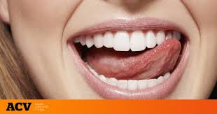 El Significado Oculto De Sonar Que Se Te Caen Los Dientes