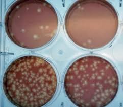 Image result for Neutralization Test