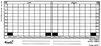 Figure C 3 A Specimen Audiogram Chart Download
