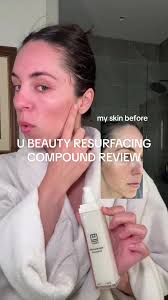 U Beauty Vs Skinbetter
