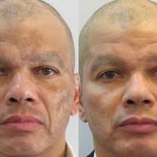 ABOUT FACE AESTHETIC CENTERS