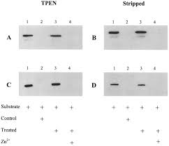 Botulinum toxin (botox) is a neurotoxic protein produced by the bacterium clostridium botulinum and related species. The Role Of Zinc Binding In The Biological Activity Of Botulinum Toxin Journal Of Biological Chemistry
