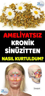 Sinuzite Karsi Kir Papatyasi Prof Dr Ibrahim Saracoglu Tarifi Saglik Papatya Sinuzit Doktor Yiyecekler Icec Saglik Saglikli Yasam Tarzi Dogal Saglik