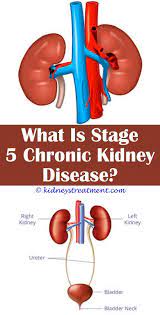 Kidney Disease Diet Nutrition Polycystic Kidney Disease Kidney Disease Recipes Kidney Disease