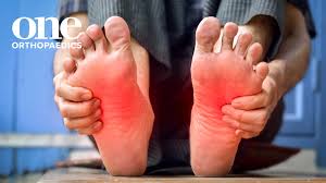 Image result for Foot Pain