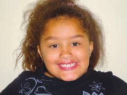 a facial dog bite injury in school age girl before repair. Fig. 5. a...