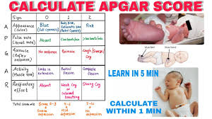 Image result for APGAR Score