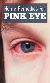 Home Remedies For Pink Eye Naturally Recipes Pinkeye Remedies Pink Eye Home Remedies Pink Eyes