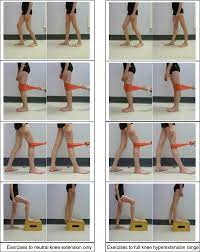 Exercises for hyperextended knee includes quarter squats, step ups which help exercises that strengthens the joint. Examples Of Exercises Performed In Each Treatment Group Download Scientific Diagram