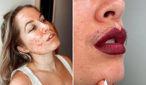 Influencer se deja el BIGOTE para combatir estándares de belleza ➡️  https://bit.ly/3iDXCyB Asegura que la depilación es un PRIVILEGIO Foto:  Instagram joannajkenny