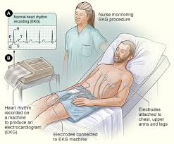 Image result for QT Interval