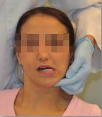 CMD-Kieler-Konzept diagnostikgesteuerte Therapie (dgT)