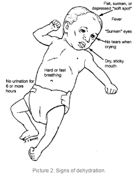 Dehydration Overview And Hydration Recommendations