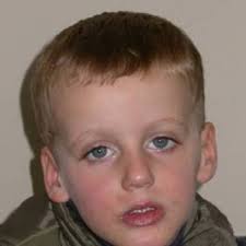 Proband at 4 years of age showing long down slanting palpebral fi...