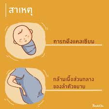 เมื่อคุณแม่ตั้งครรภ์มีอาการปวดหลัง มีวิธีรับมือยังไงบ้าง