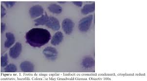 Http Www Medicina Interna Ro Articol Php Articol 788 Lang Ro