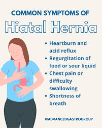 Image result for stomach hernia symptoms