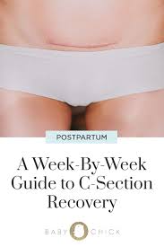 A Week By Week Guide To C Section Recovery C Section Recovery C Section C Section Workout