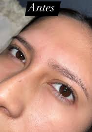 ventas fomerrey 7, 18 y 31