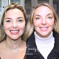 I am excited to share that our Phase 3 clinical trial results