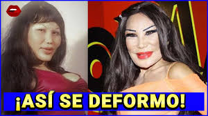 Lyn may antes de las cirugias. Lyn May Relata Transformacion De Su Cara Youtube