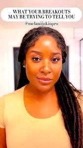 Heyyy y’all! So I get questions all the time about breakouts.. here’s a  quick breakdown of what they could be trying to tell you. , • Forehead