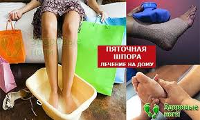 как избавиться от шпоры на стопе в домашних условиях V Etoj State Vy Uznaete Kak Vylechit Pyatochnuyu Shporu V Domashnih Usloviyah Pyatochnaya Shpora Medicina Bol V Pyatke