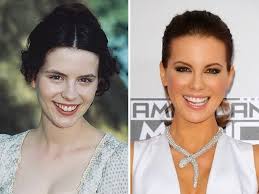 I think you can chalk it up to several changes: Kate Beckinsale Before And After Plastic Surgery Face Nose Breast