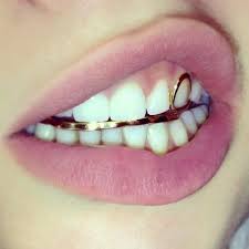 Gilded Teeth And Mouth Jewelry Gold Teeth Grillz Teeth Jewelry