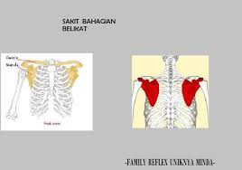 We did not find results for: Orang Menderita Sakit Family Reflexology Semenyih Facebook