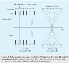 3d and 2d normalization (~6.5 hrs). Image Reconstruction For Pet Ct Scanners Past Achievements And Future Challenges