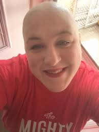 Explaining My Hair Loss to My 3-Year-Old Daughter