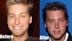 cominbackagain, posts by tag: lance