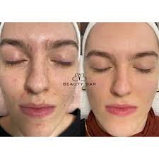 Beauty bar, viki hiersche, wr. Beauty Bar Die Fachkosmetikerin Home Facebook
