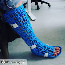 Repost 3d Printing 101 Really Interesting Idea Do You Think It Is Possible Leave Your Answer In The Comments Below Anufa Leg Cast It Cast Medical Design