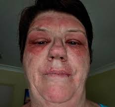 How young and old is everybody here? Just curious. 43years old her.