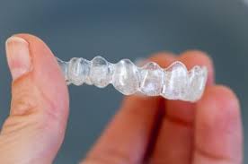 An essential part of the invisalign process is ensuring that both the aligners and your teeth are as clean as possible. Invisalign Aligner Cleaning Dos And Donts Call Today 855 614 5221 California Dental Group