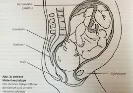 Vielen dank im voraus für ihre hilfe. Ihr Kind Dreht Sich Wie Ein Brummkreisel In Ihrem Becken Besonderheiten Von Sternenguckern Und Was Es Zu Beachten Gilt Hypnobirthing By Mother Birth