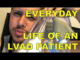 LVAD