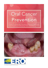 Difficulty chewing or pain while chewing. Pdf Oral Cancer Prevention