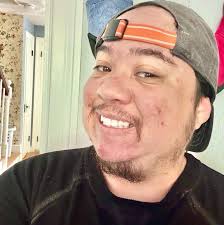 Orchiectomy Surgery as Part of Transitioning Journey