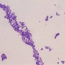 Image result for Tinnea apiculata